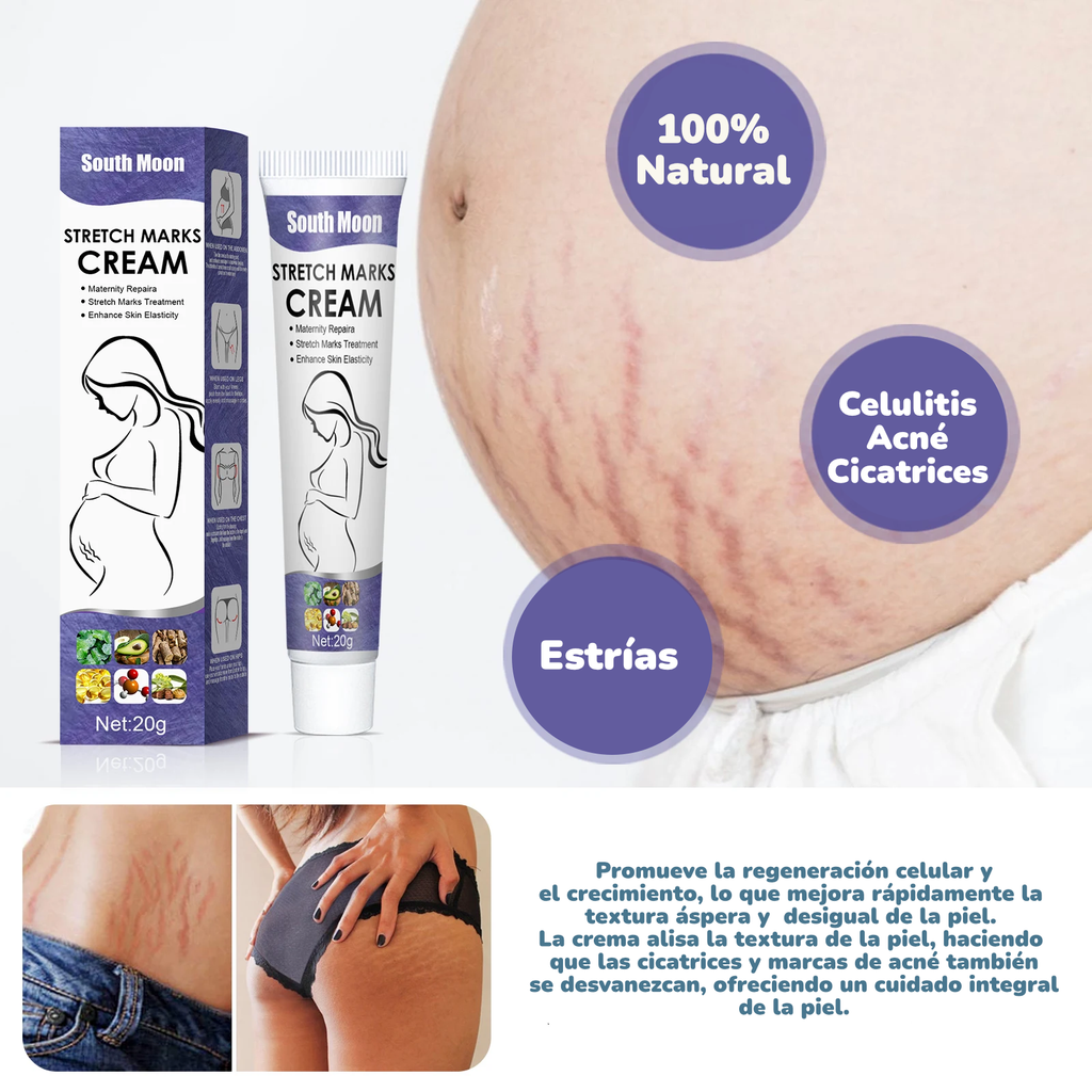 Crema Intensiva para Estrías South Moon | Mejora Elasticidad, Desvanece Líneas de Crecimiento y Reafirma
